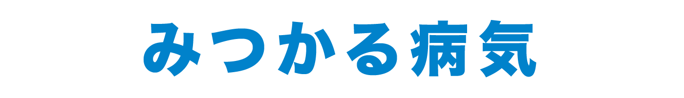 内視鏡検査